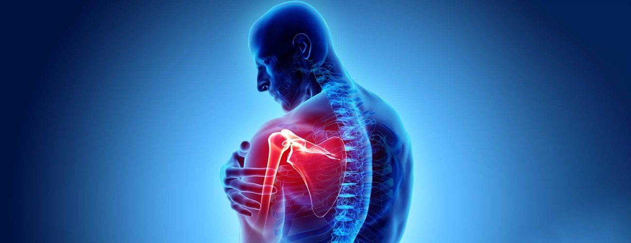 What Is Arthritis