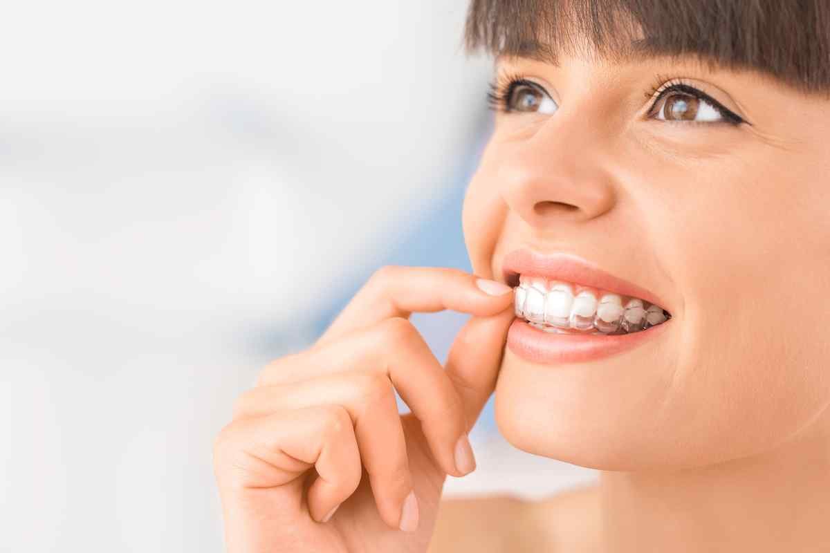Clear Confidence: The Complete Guide to Dental Aligners for a Modern Smile